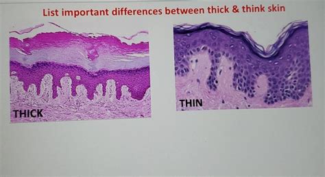 thick or thin skin test|thick skin test.